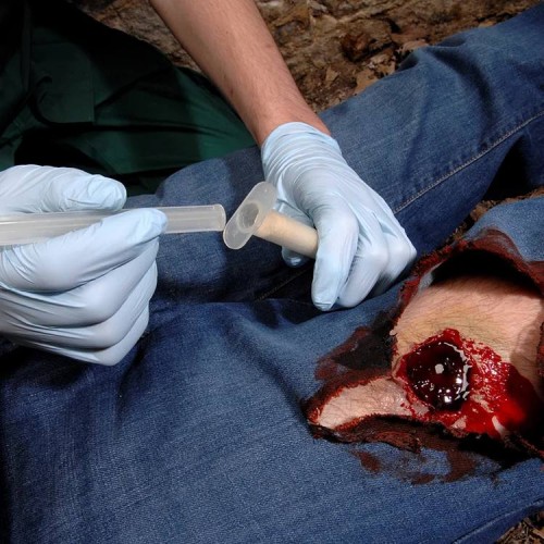 Аппликатор гемостатический с гранулами Rhino Rescue в Альметьевске хитозановый